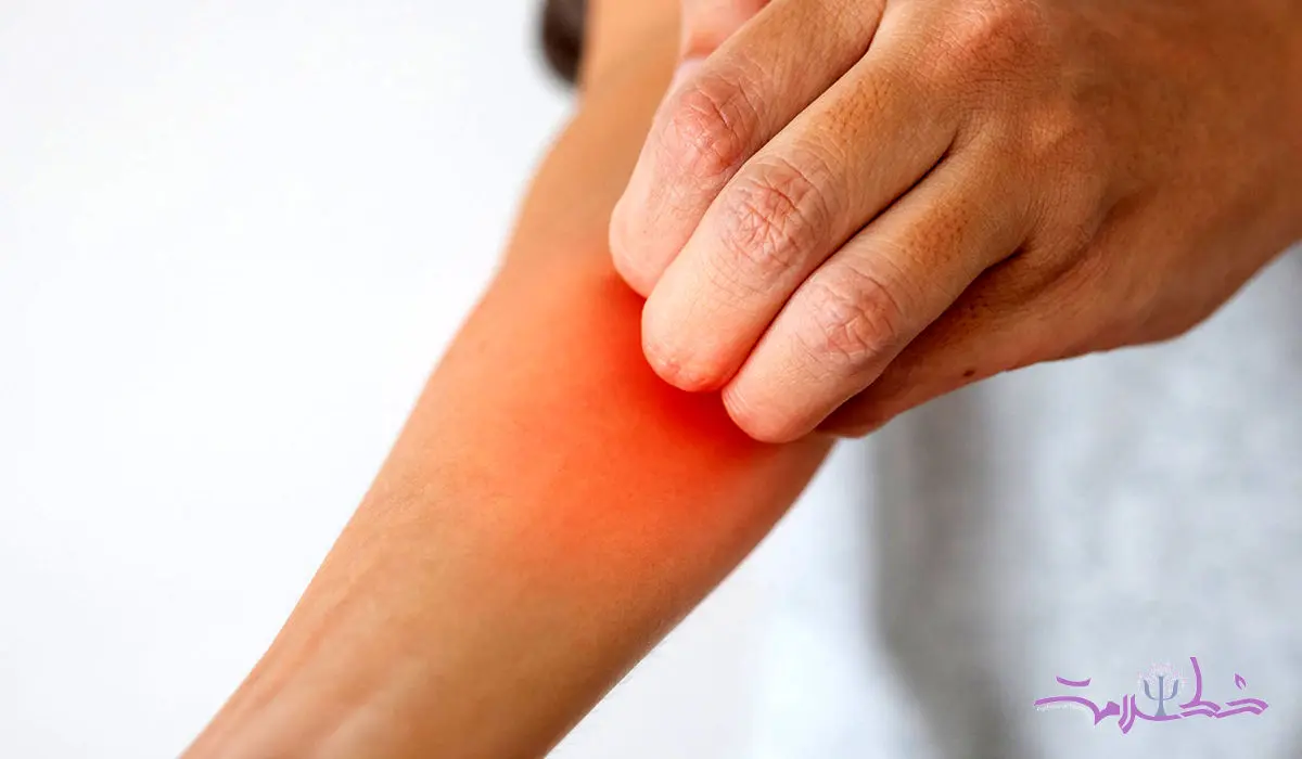 راه‌های کاهش خارش پوست بعد از اصلاح با تیغ و ژیلت