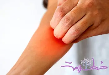 راه‌های کاهش خارش پوست بعد از اصلاح با تیغ و ژیلت